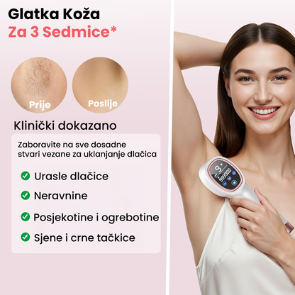 ICE COOL PRO™ – Epilator nove generacije